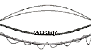 dt_overwire_t